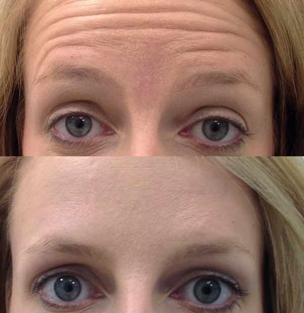 bottos per rrudhatykm https://ykm.al/wp-content/uploads/2022/09/bottos-per-rrudhatykm.jpg