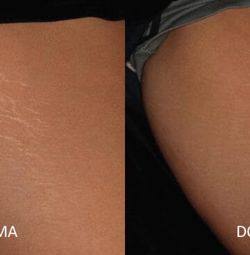 strijat dhe plaget https://ykm.al/wp-content/uploads/2022/09/strijat-dhe-plaget-360x367.jpg